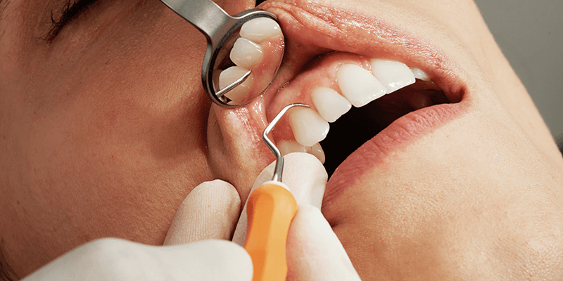 benefits-dental